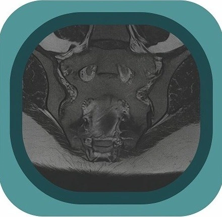 MRI sacrum anatomy icon